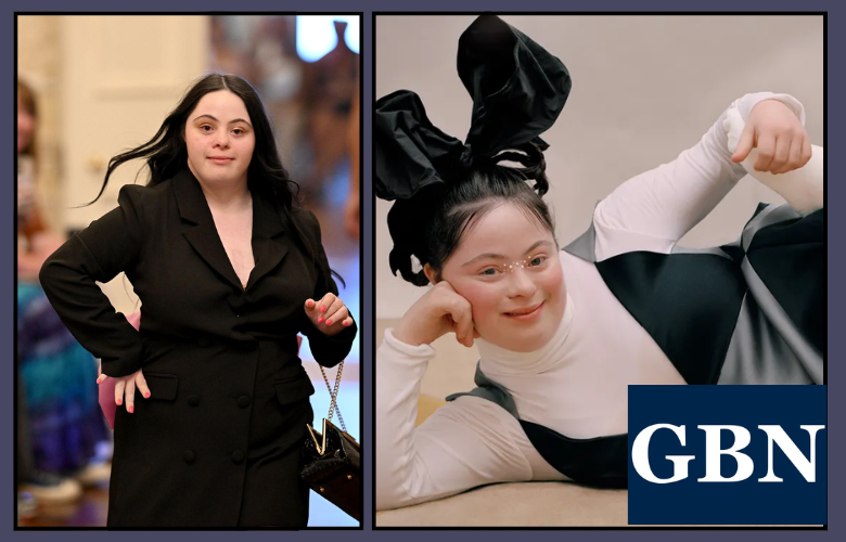 Ellie Goldstein Strictly Come Dancing Journey Movies TV Shows and Net Worth Details